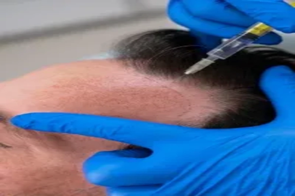 Best Hair Clinic & Hair Specialist in Aundh, & Nearby Areas
